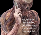 coup_de_soleil